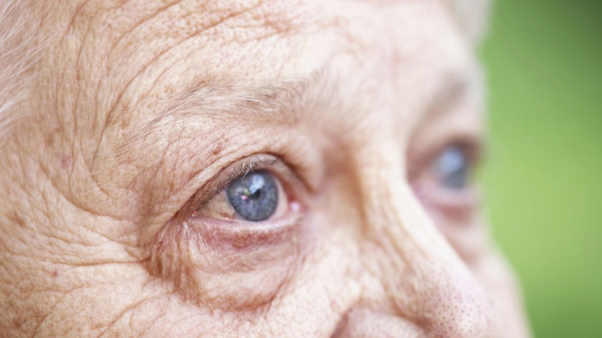 катаракты у пожилых людей